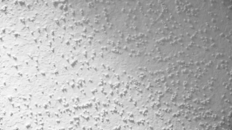 Plaster